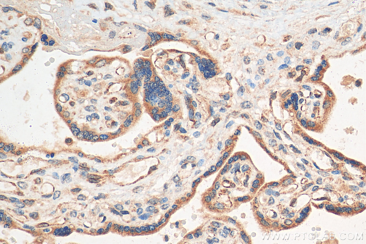 Immunohistochemistry (IHC) staining of human placenta tissue using CCL17 Polyclonal antibody (22342-1-AP)