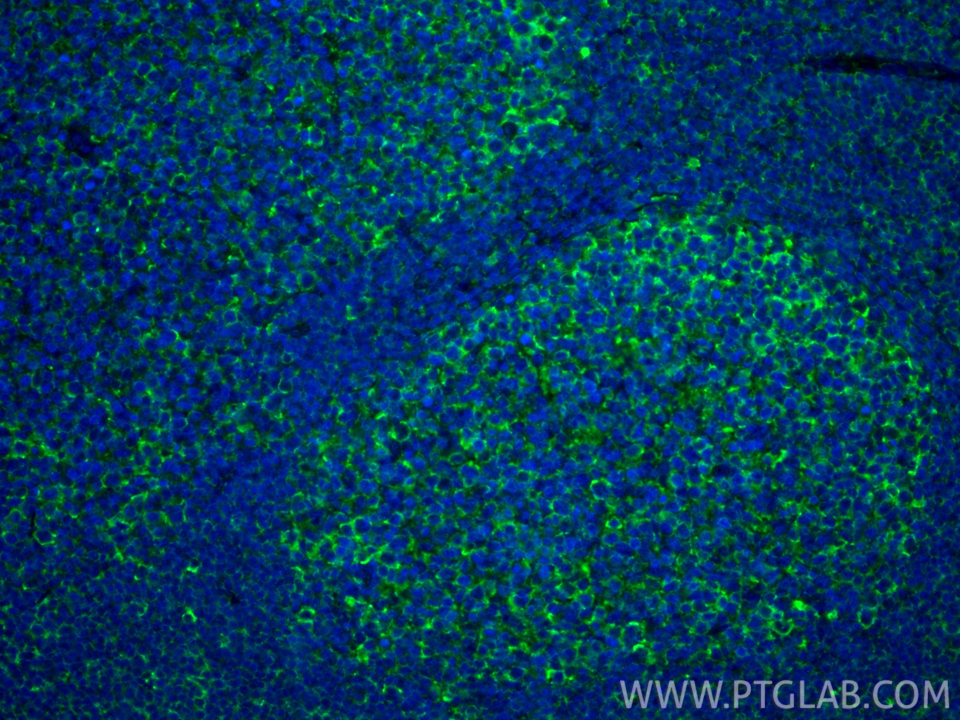 Immunofluorescence (IF) / fluorescent staining of human tonsillitis tissue using CCL18/MIP-4 Polyclonal antibody (22303-1-AP)