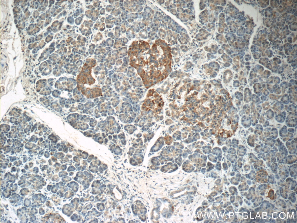 Immunohistochemistry (IHC) staining of human pancreas tissue using CCL18/MIP-4 Polyclonal antibody (22303-1-AP)