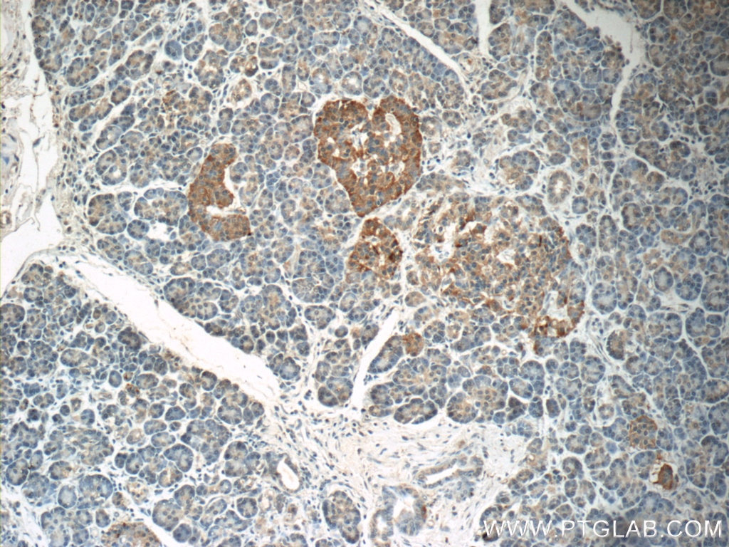 IHC staining of human pancreas using 22303-1-AP