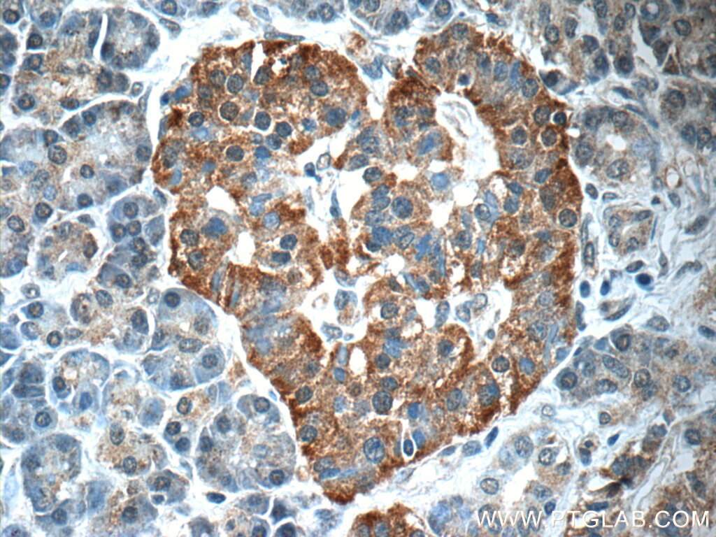 Immunohistochemistry (IHC) staining of human pancreas tissue using CCL18/MIP-4 Polyclonal antibody (22303-1-AP)