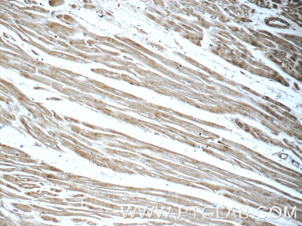 Immunohistochemistry (IHC) staining of human heart tissue using CCL18/MIP-4 Polyclonal antibody (22303-1-AP)