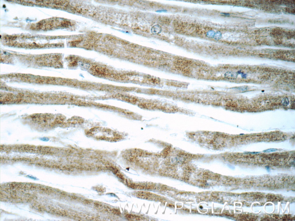 Immunohistochemistry (IHC) staining of human heart tissue using CCL18/MIP-4 Polyclonal antibody (22303-1-AP)