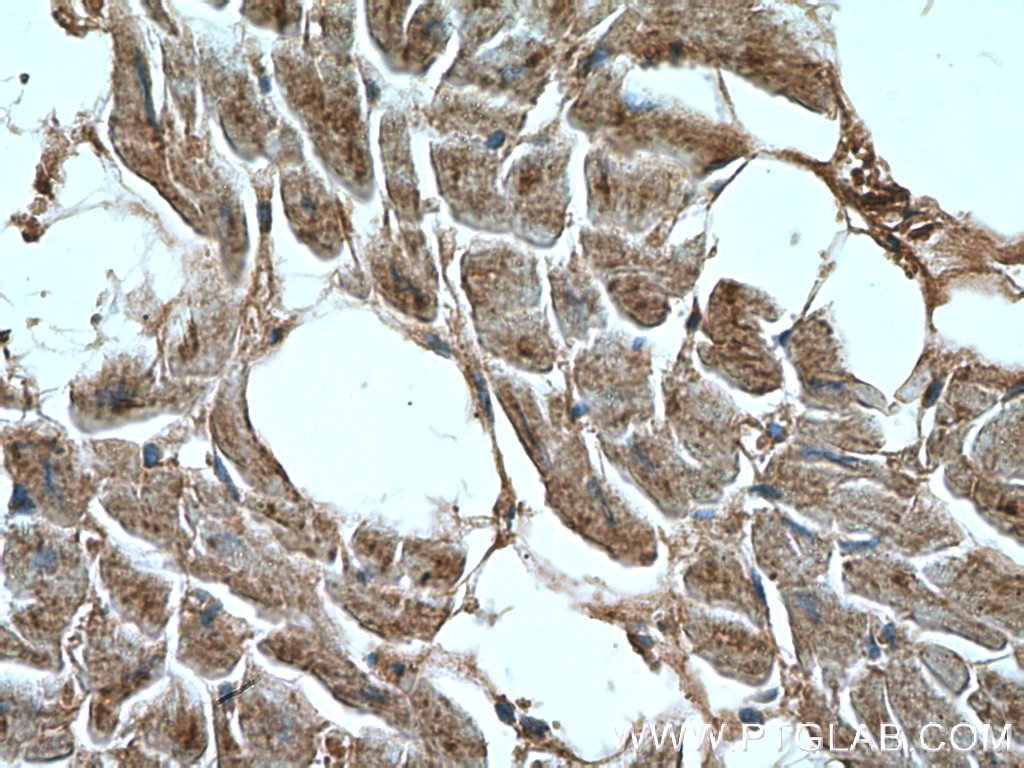 Immunohistochemistry (IHC) staining of human heart tissue using CCL18/MIP-4 Polyclonal antibody (22303-1-AP)