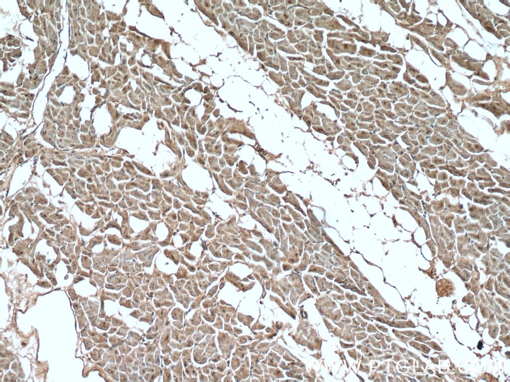 IHC staining of human heart using 22303-1-AP