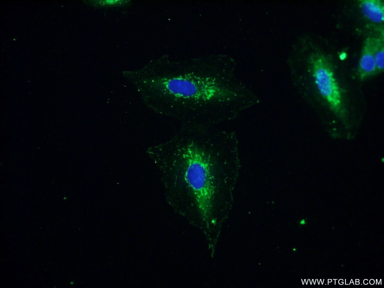 Immunofluorescence (IF) / fluorescent staining of A549 cells using MIP-3 Beta Polyclonal antibody (13397-1-AP)