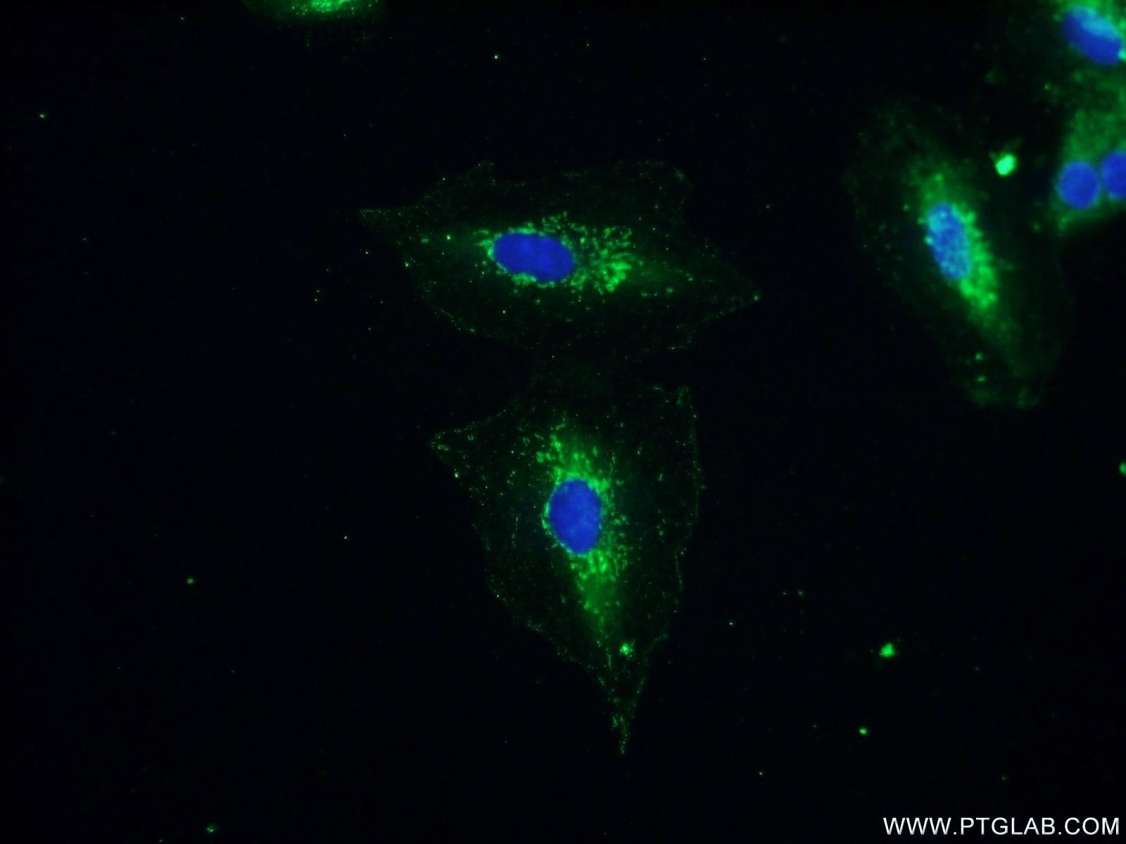 IF Staining of A549 using 13397-1-AP