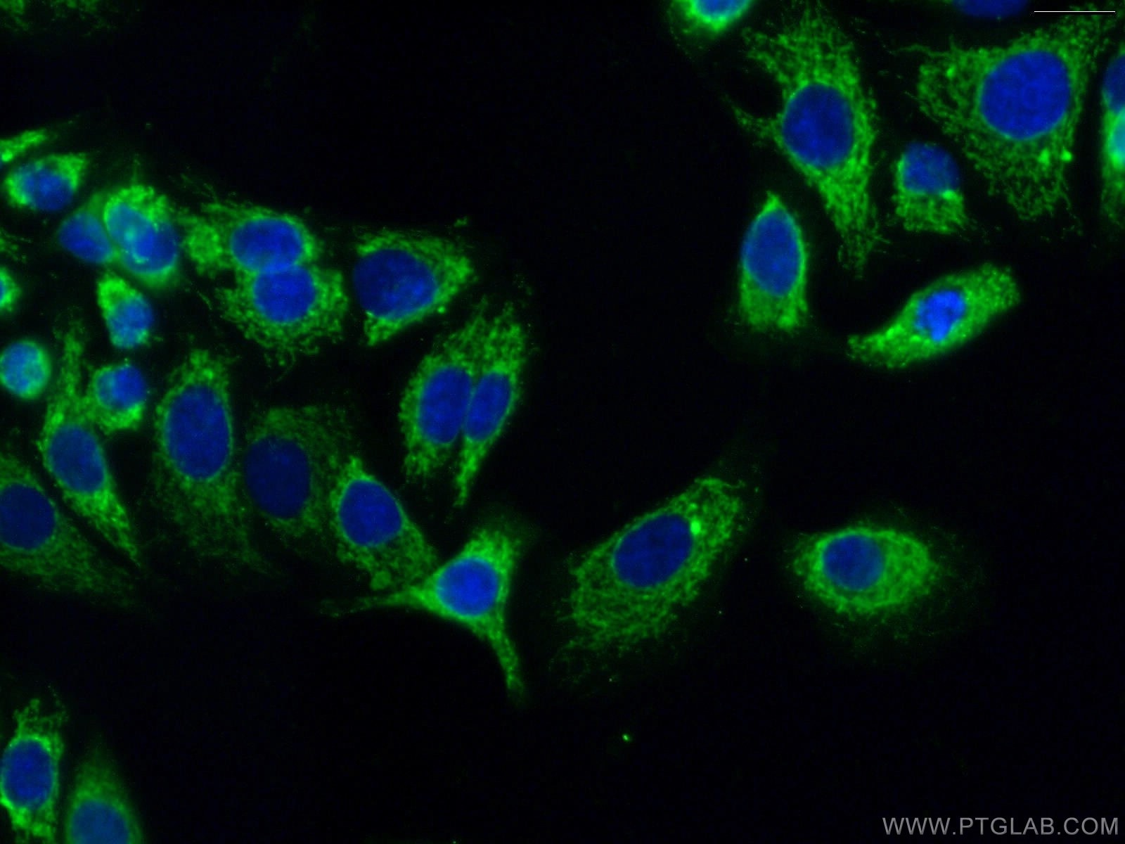 Immunofluorescence (IF) / fluorescent staining of A549 cells using MIP-3 Beta Polyclonal antibody (13397-1-AP)