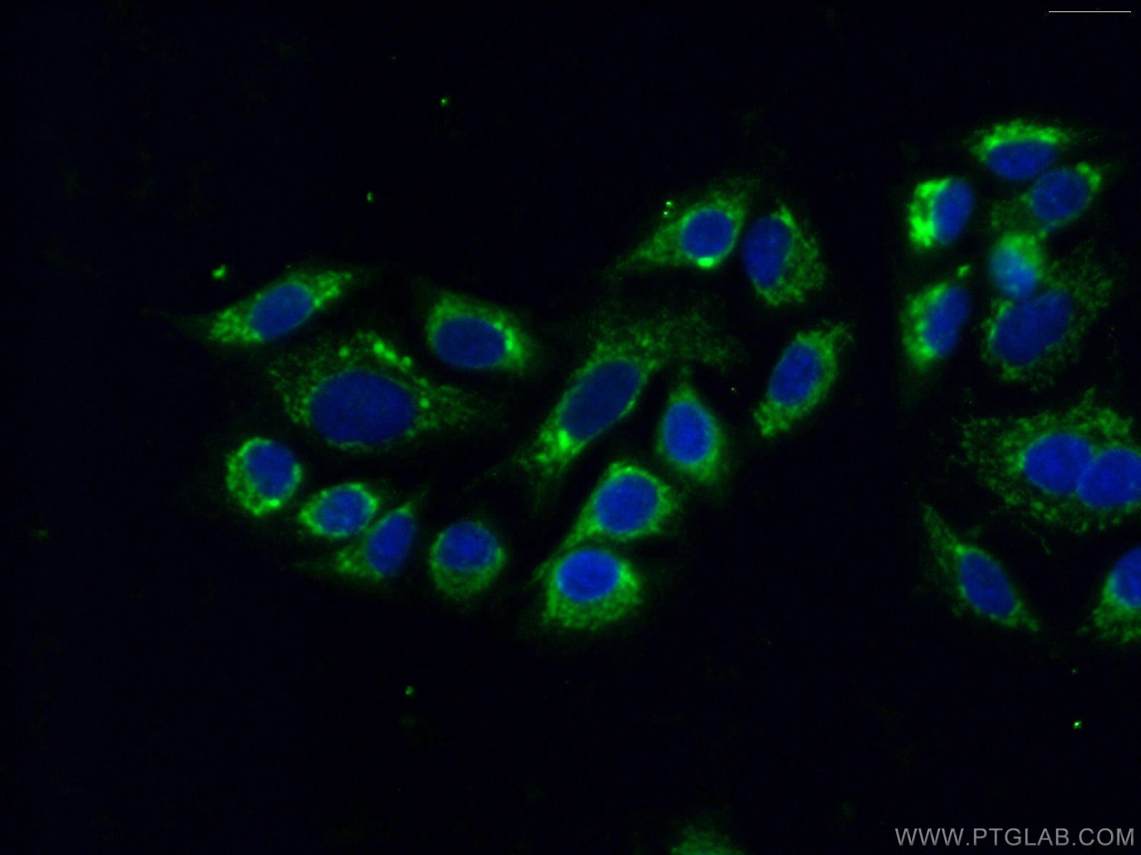 Immunofluorescence (IF) / fluorescent staining of A549 cells using MIP-3 Beta Polyclonal antibody (13397-1-AP)