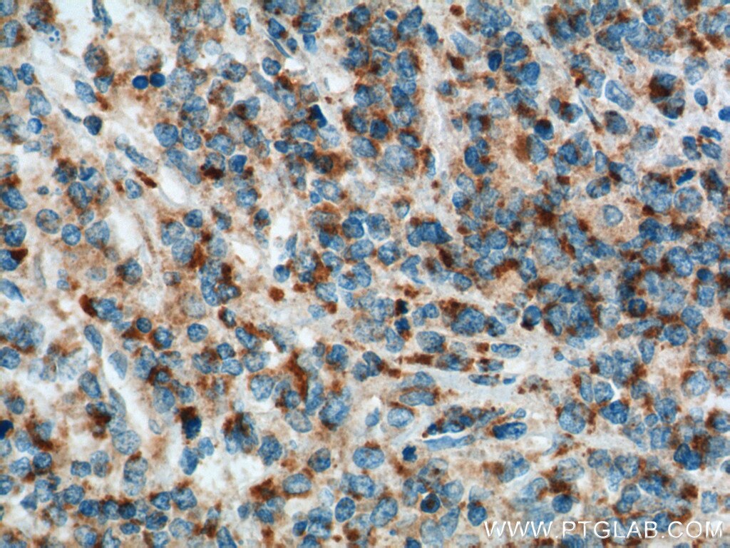 MIP-3 Beta Polyclonal antibody