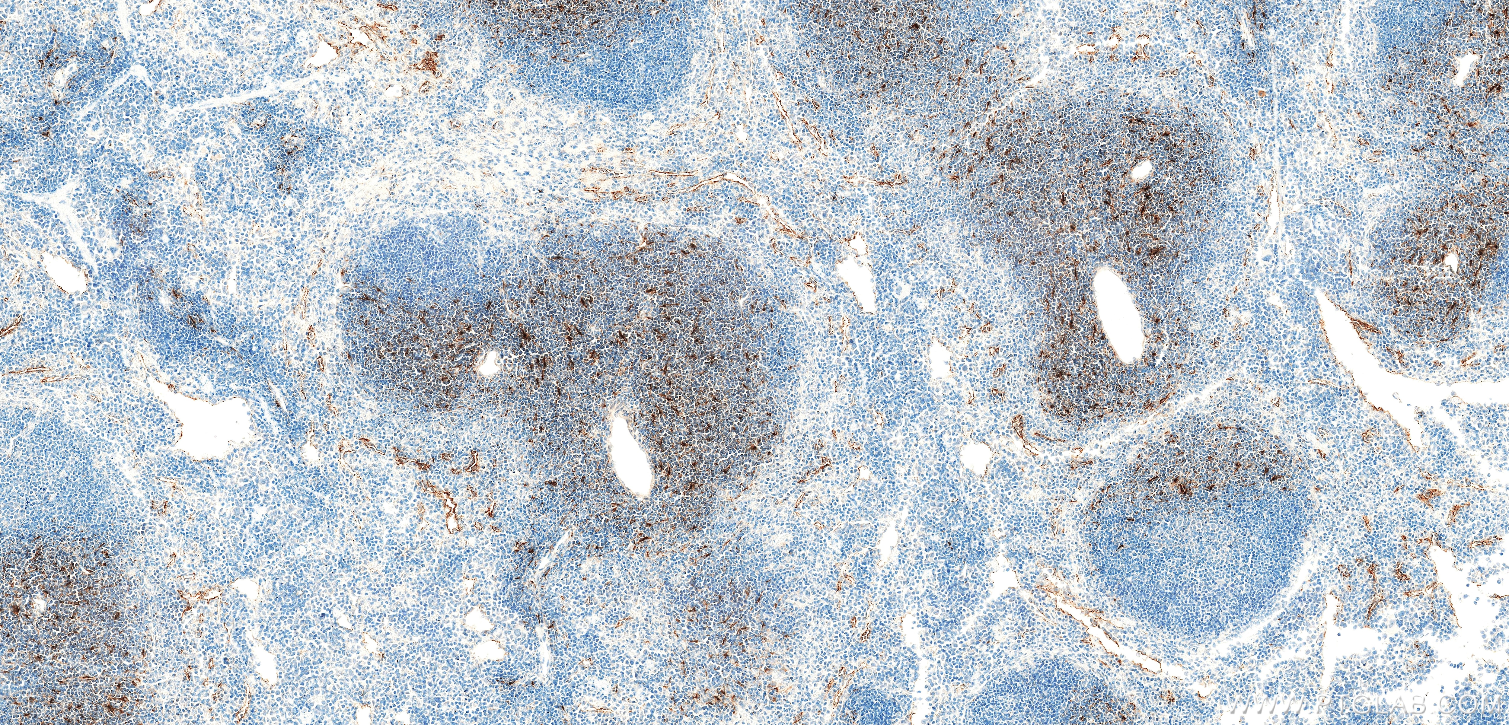 Immunohistochemistry (IHC) staining of mouse spleen tissue using CCL19/MIP-3 beta Recombinant monoclonal antibody (85861-1-RR)