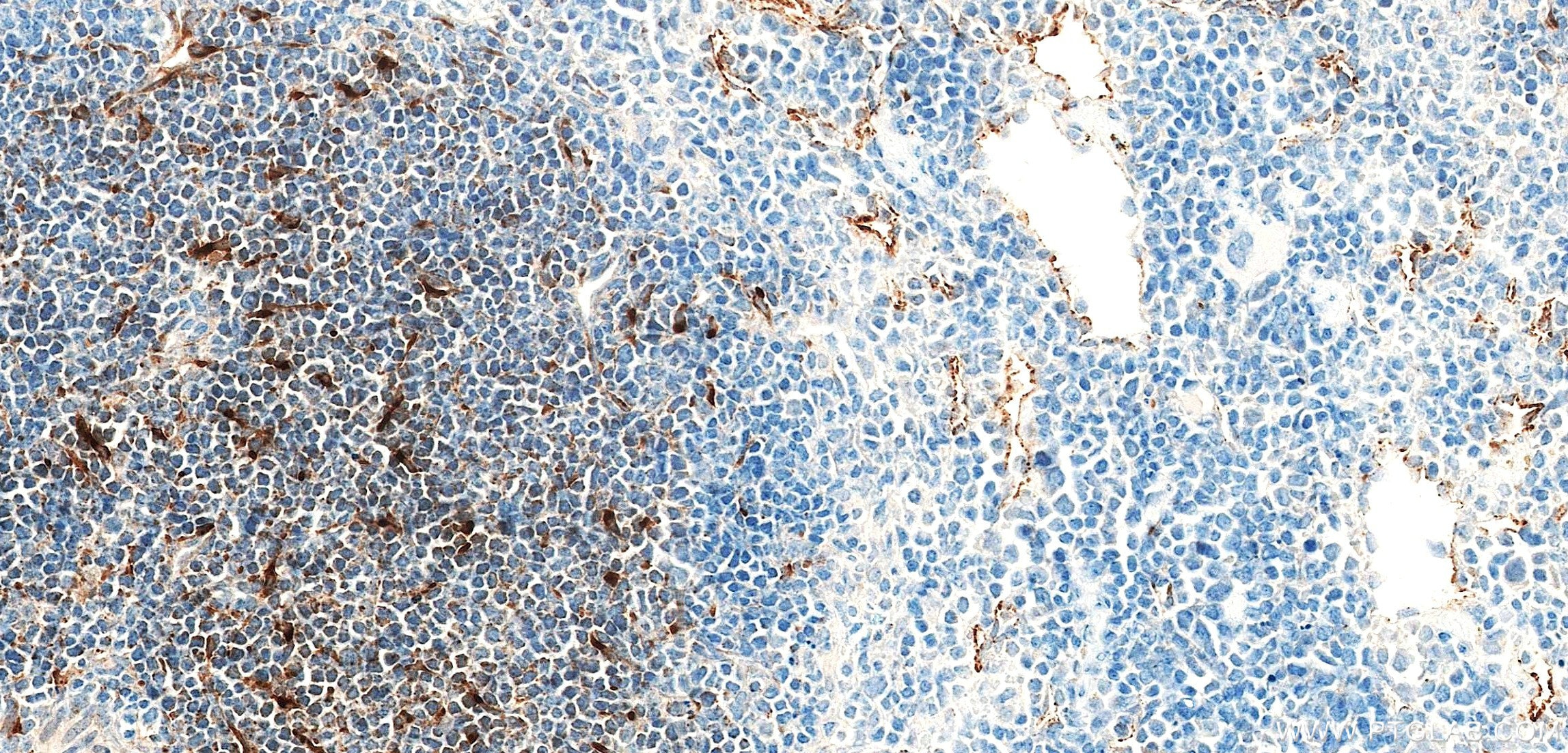 Immunohistochemistry (IHC) staining of mouse spleen tissue using CCL19/MIP-3 beta Recombinant monoclonal antibody (85861-1-RR)
