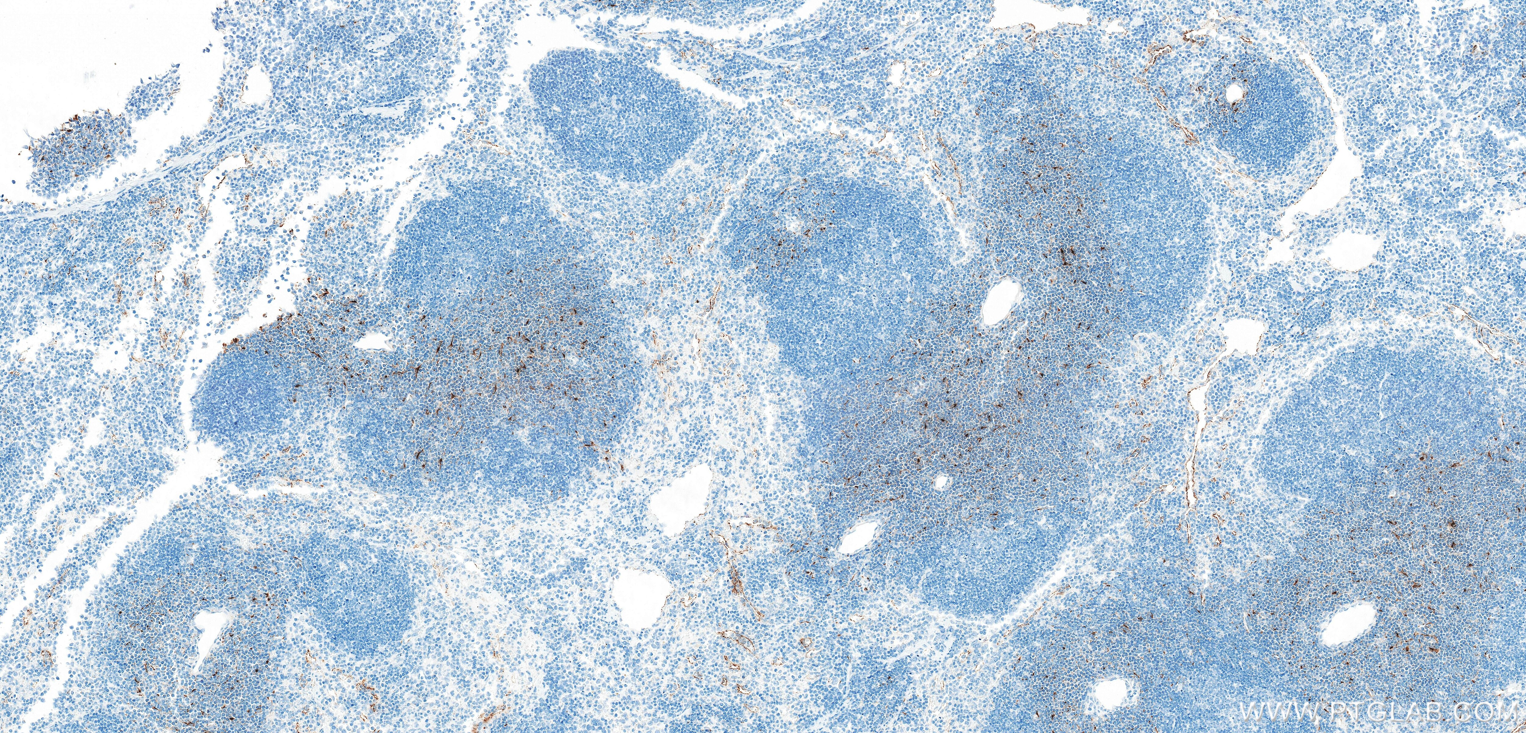 Immunohistochemistry (IHC) staining of mouse spleen tissue using CCL19/MIP-3 beta Recombinant monoclonal antibody (85861-1-RR)