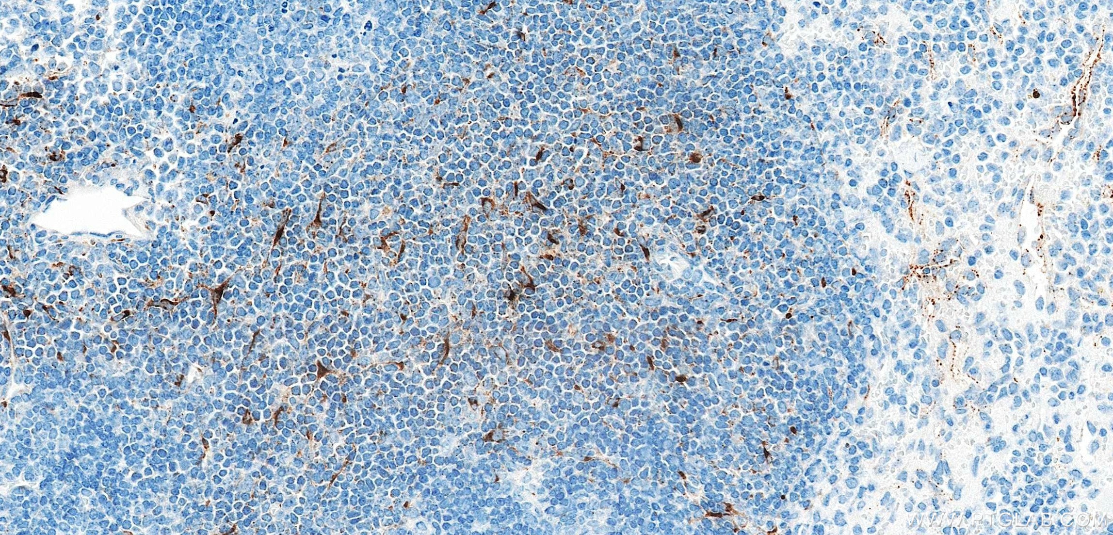 Immunohistochemistry (IHC) staining of mouse spleen tissue using CCL19/MIP-3 beta Recombinant monoclonal antibody (85861-1-RR)