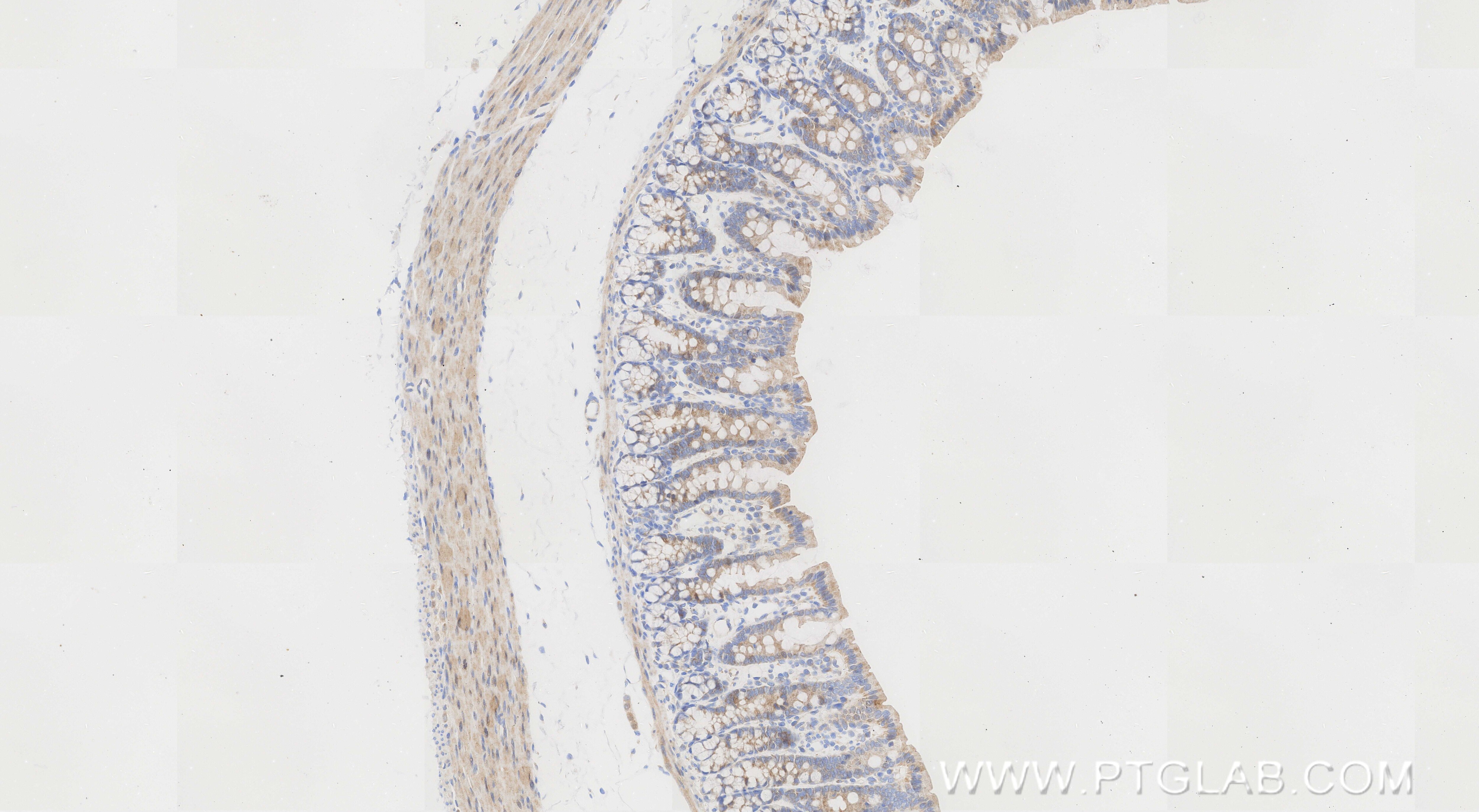 Immunohistochemical analysis of paraffin-embedded rat colon tissue slide using 86607-3-RR (CCL20/MIP-3 alpha antibody) at dilution of 1:1000 (under 10x lens). Heat mediated antigen retrieval with Tris-EDTA buffer (pH 9.0). This data was developed using the same antibody clone with 86607-3-PBS in a different storage buffer formulation. Immunohistochemistry (IHC) staining of rat colon tissue using CCL20/MIP-3 alpha Recombinant monoclonal antibody (86607-3-RR)
