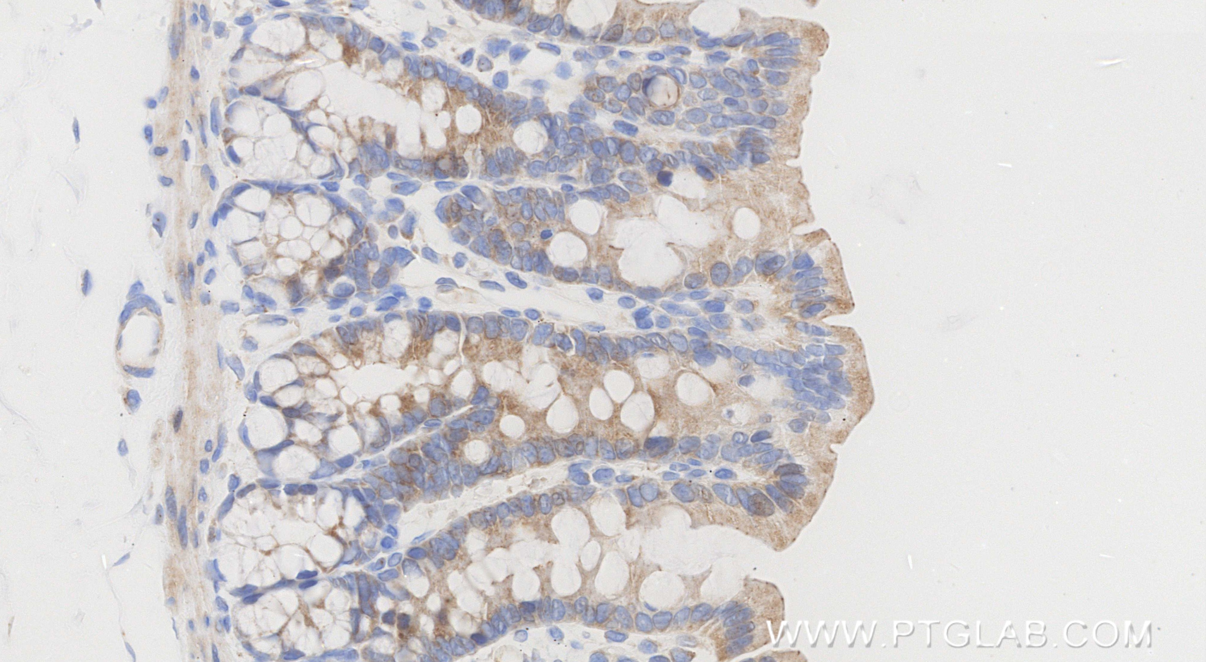 Immunohistochemical analysis of paraffin-embedded rat colon tissue slide using 86607-3-RR (CCL20/MIP-3 alpha antibody) at dilution of 1:1000 (under 40x lens). Heat mediated antigen retrieval with Tris-EDTA buffer (pH 9.0). This data was developed using the same antibody clone with 86607-3-PBS in a different storage buffer formulation. Immunohistochemistry (IHC) staining of rat colon tissue using CCL20/MIP-3 alpha Recombinant monoclonal antibody (86607-3-RR)