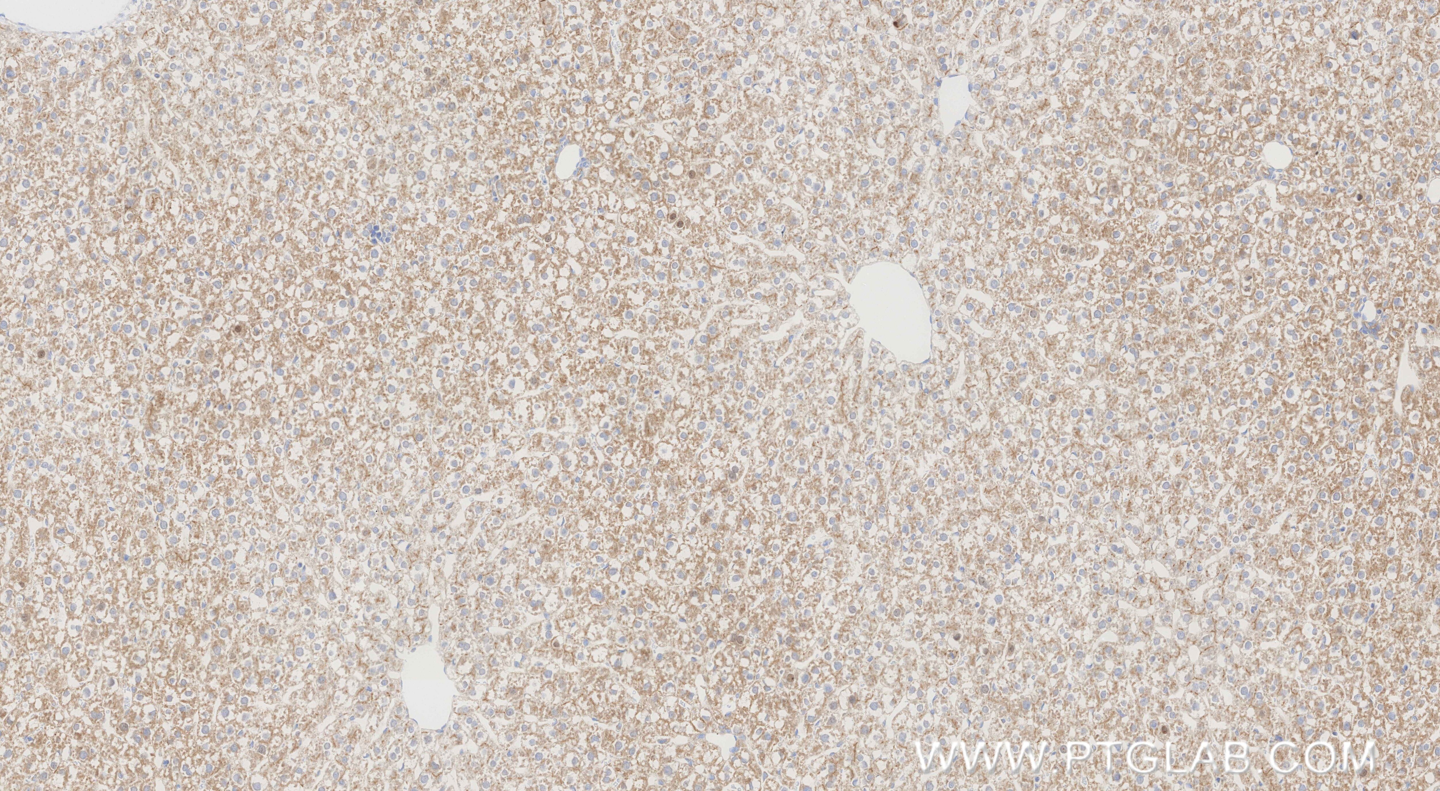 Immunohistochemical analysis of paraffin-embedded rat liver tissue slide using 86607-3-RR (CCL20/MIP-3 alpha antibody) at dilution of 1:1000 (under 10x lens). Heat mediated antigen retrieval with Tris-EDTA buffer (pH 9.0). This data was developed using the same antibody clone with 86607-3-PBS in a different storage buffer formulation. Immunohistochemistry (IHC) staining of rat liver tissue using CCL20/MIP-3 alpha Recombinant monoclonal antibody (86607-3-RR)
