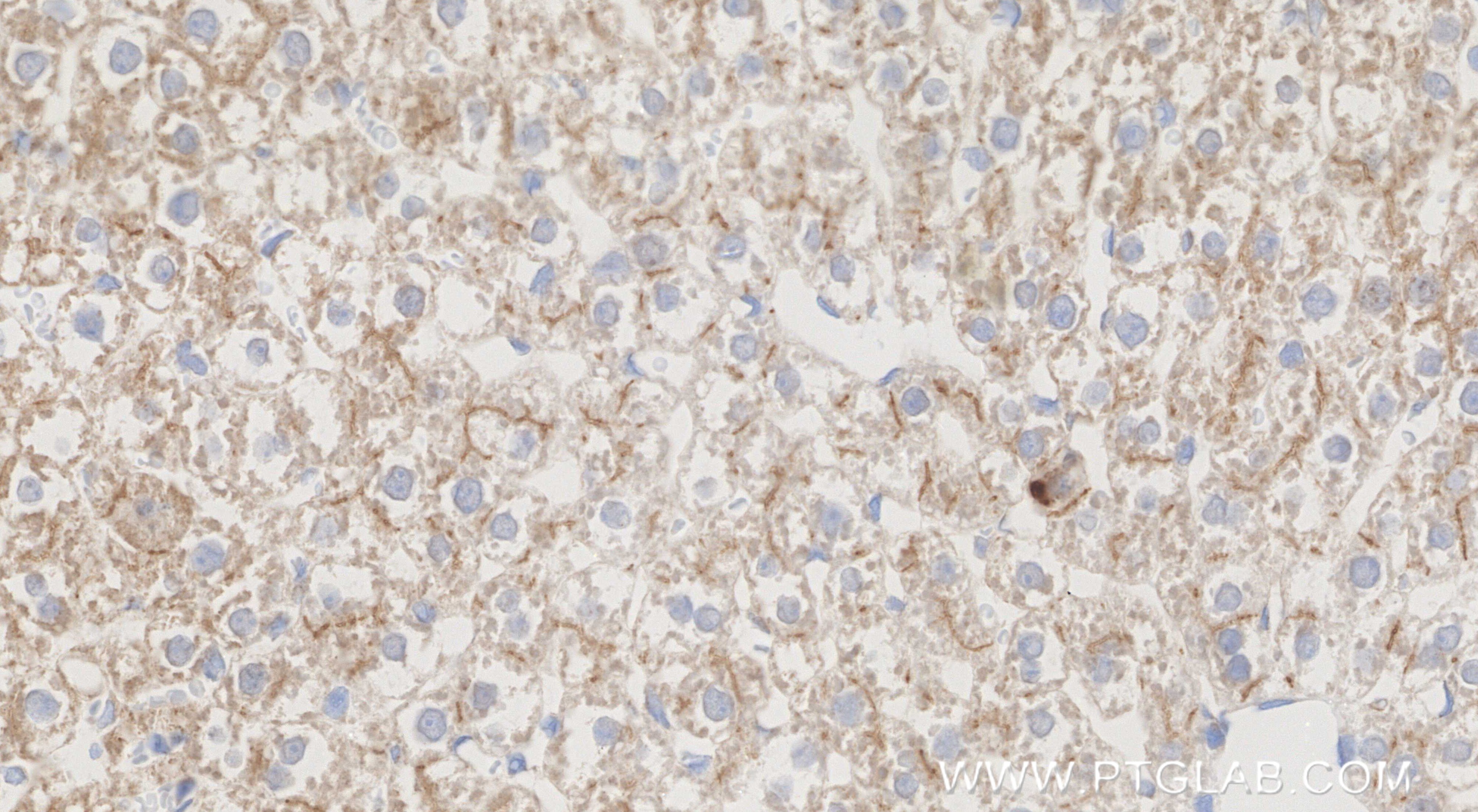 Immunohistochemical analysis of paraffin-embedded rat liver tissue slide using 86607-3-RR (CCL20/MIP-3 alpha antibody) at dilution of 1:1000 (under 40x lens). Heat mediated antigen retrieval with Tris-EDTA buffer (pH 9.0). This data was developed using the same antibody clone with 86607-3-PBS in a different storage buffer formulation. Immunohistochemistry (IHC) staining of rat liver tissue using CCL20/MIP-3 alpha Recombinant monoclonal antibody (86607-3-RR)
