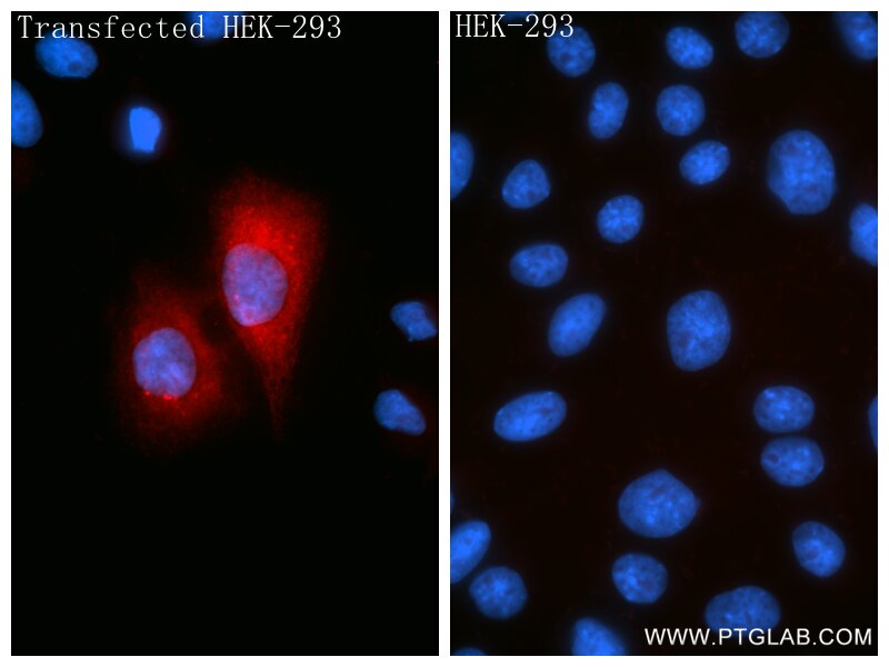 Immunofluorescent analysis of (4% PFA) fixed Transfected HEK-293 cells using CCL20/MIP-3 alpha antibody (86916-1-RR, Clone: 250239B2 ) at dilution of 1:400 and CoraLite®488-Conjugated Goat Anti-Rabbit IgG(H+L) (SA00013-2). This data was developed using the same antibody clone with 86916-1-PBS in a different storage buffer formulation. Immunofluorescence (IF) / fluorescent staining of Transfected HEK-293 cells using CCL20/MIP-3 alpha Recombinant monoclonal antibody (86916-1-RR)