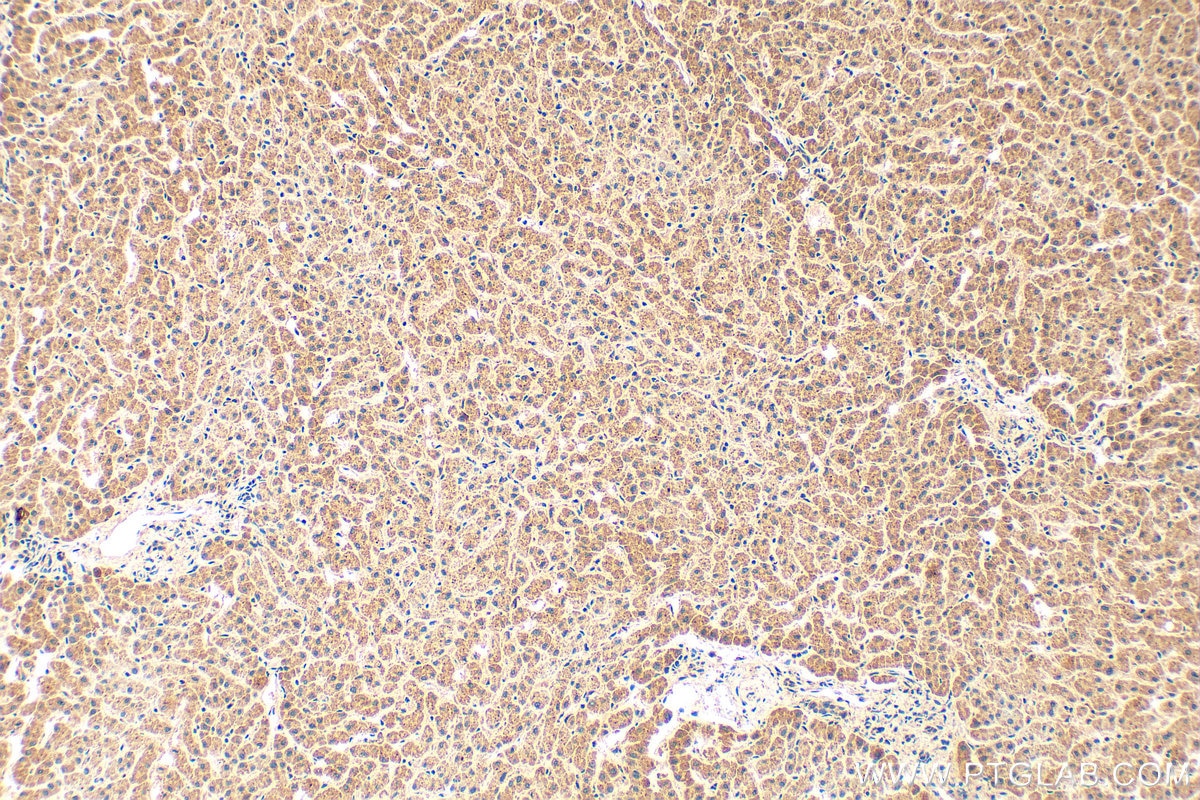Immunohistochemical analysis of paraffin-embedded human liver tissue slide using 17865-1-AP (CCL23 antibody) at dilution of 1:200 (under 10x lens). Heat mediated antigen retrieval with Tris-EDTA buffer (pH 9.0). Immunohistochemistry (IHC) staining of human liver tissue using CCL23 Polyclonal antibody (17865-1-AP)