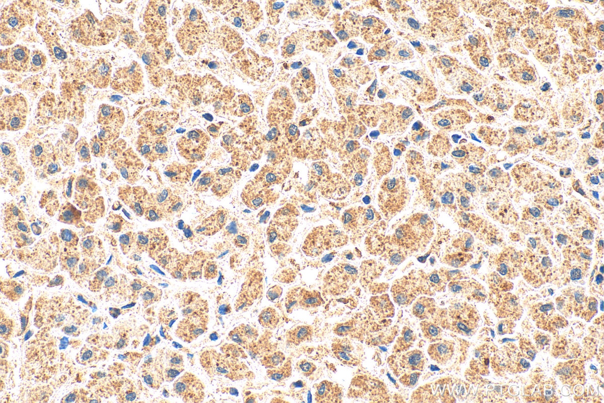 Immunohistochemical analysis of paraffin-embedded human liver tissue slide using 17865-1-AP (CCL23 antibody) at dilution of 1:200 (under 40x lens). Heat mediated antigen retrieval with Tris-EDTA buffer (pH 9.0). Immunohistochemistry (IHC) staining of human liver tissue using CCL23 Polyclonal antibody (17865-1-AP)