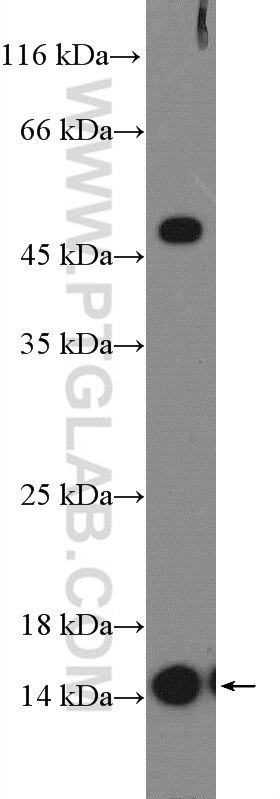 Western Blot (WB) analysis of mouse thymus tissue using CCL24/Eotaxin 2 Polyclonal antibody (22306-1-AP)