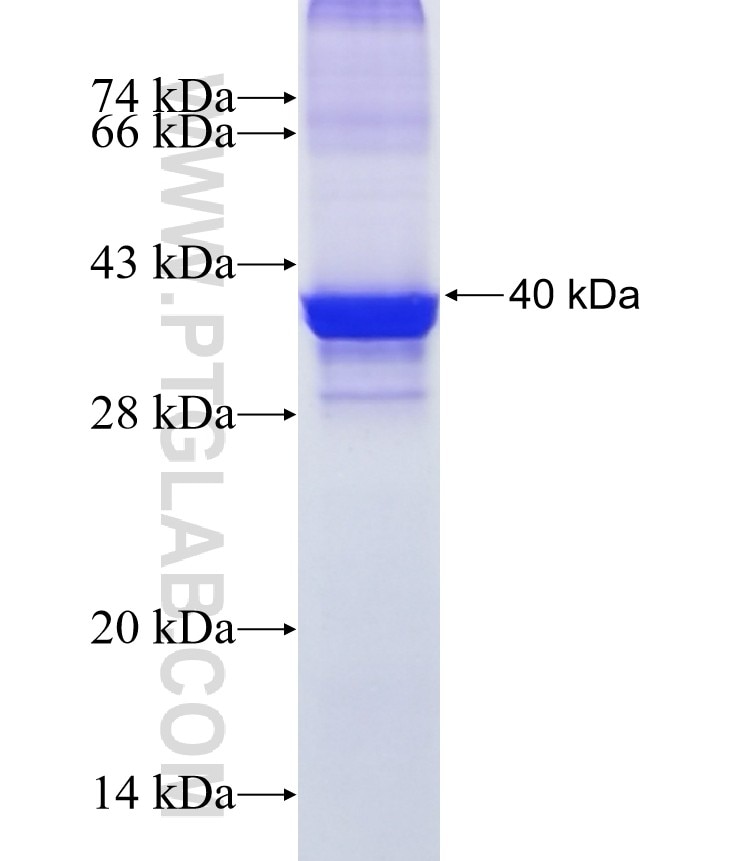 CCL25 fusion protein Ag17994 SDS-PAGE