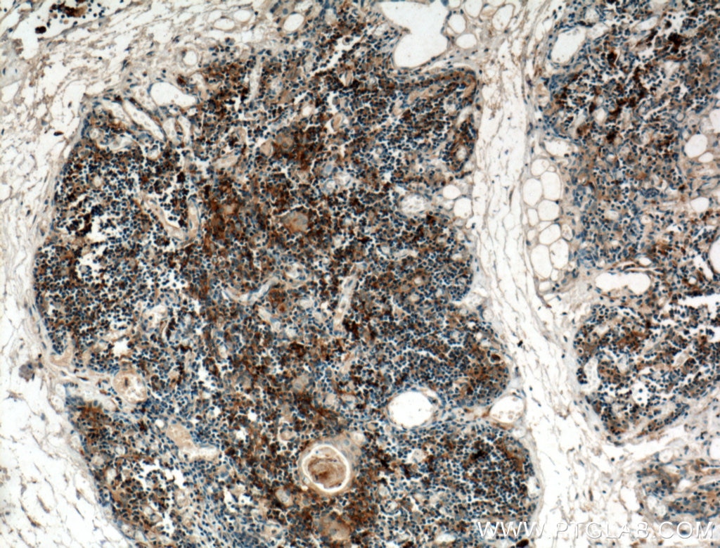 Immunohistochemistry (IHC) staining of human thymus tissue using CCL25/TECK Polyclonal antibody (25285-1-AP)