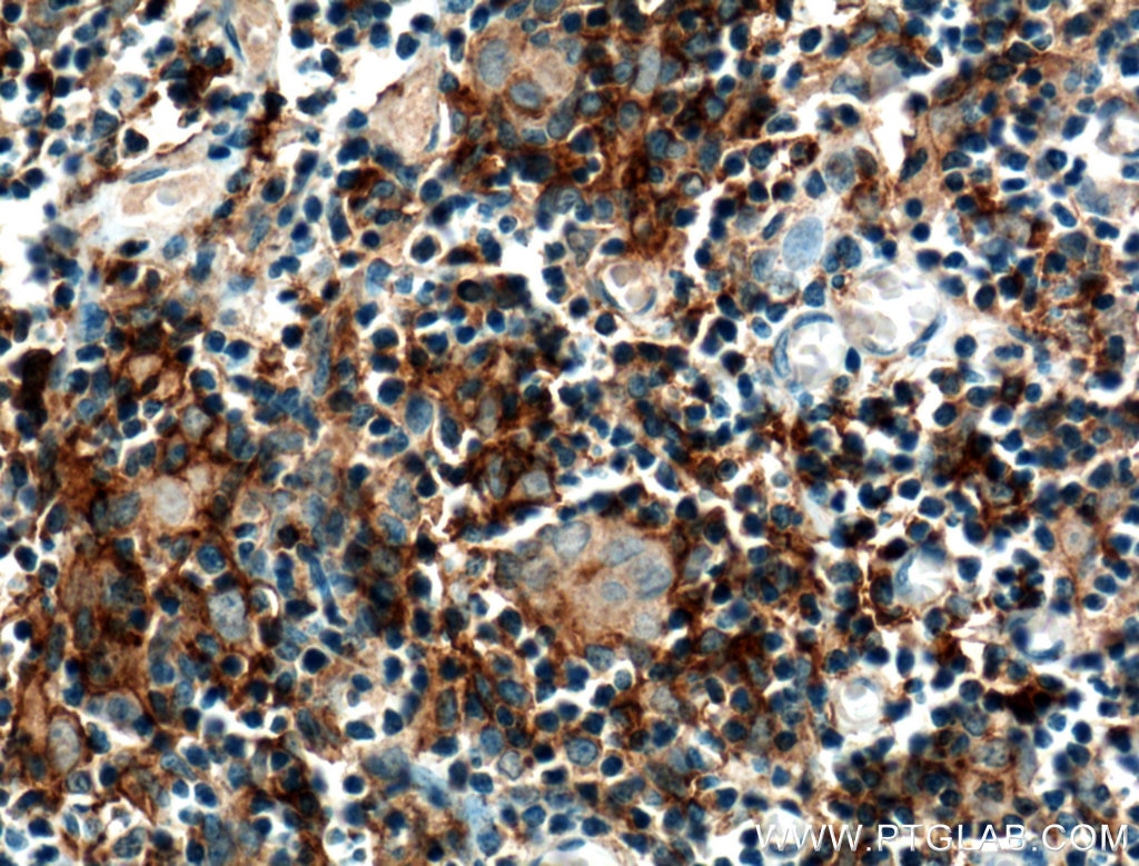 Immunohistochemistry (IHC) staining of human thymus tissue using CCL25/TECK Polyclonal antibody (25285-1-AP)