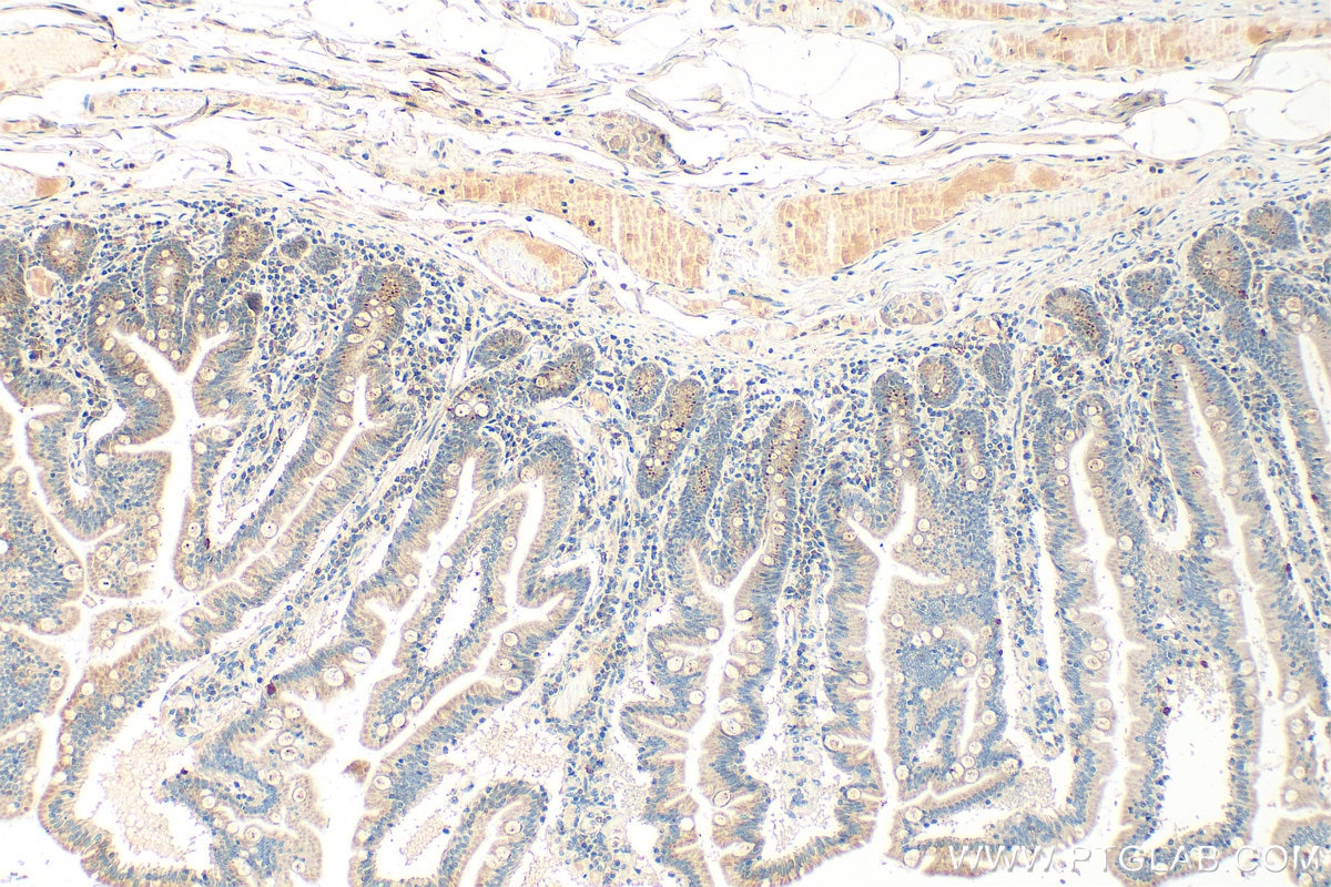 Immunohistochemistry (IHC) staining of human small intestine tissue using CCL25/TECK Polyclonal antibody (25285-1-AP)
