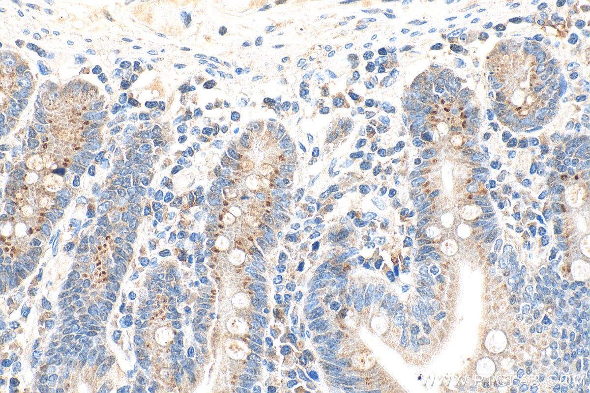 Immunohistochemistry (IHC) staining of human small intestine tissue using CCL25/TECK Polyclonal antibody (25285-1-AP)