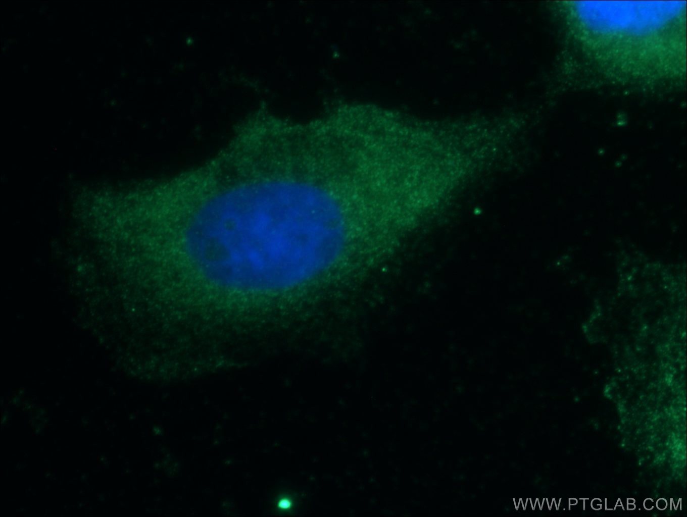 Immunofluorescence (IF) / fluorescent staining of A431 cells using CCL27 Polyclonal antibody (22301-1-AP)