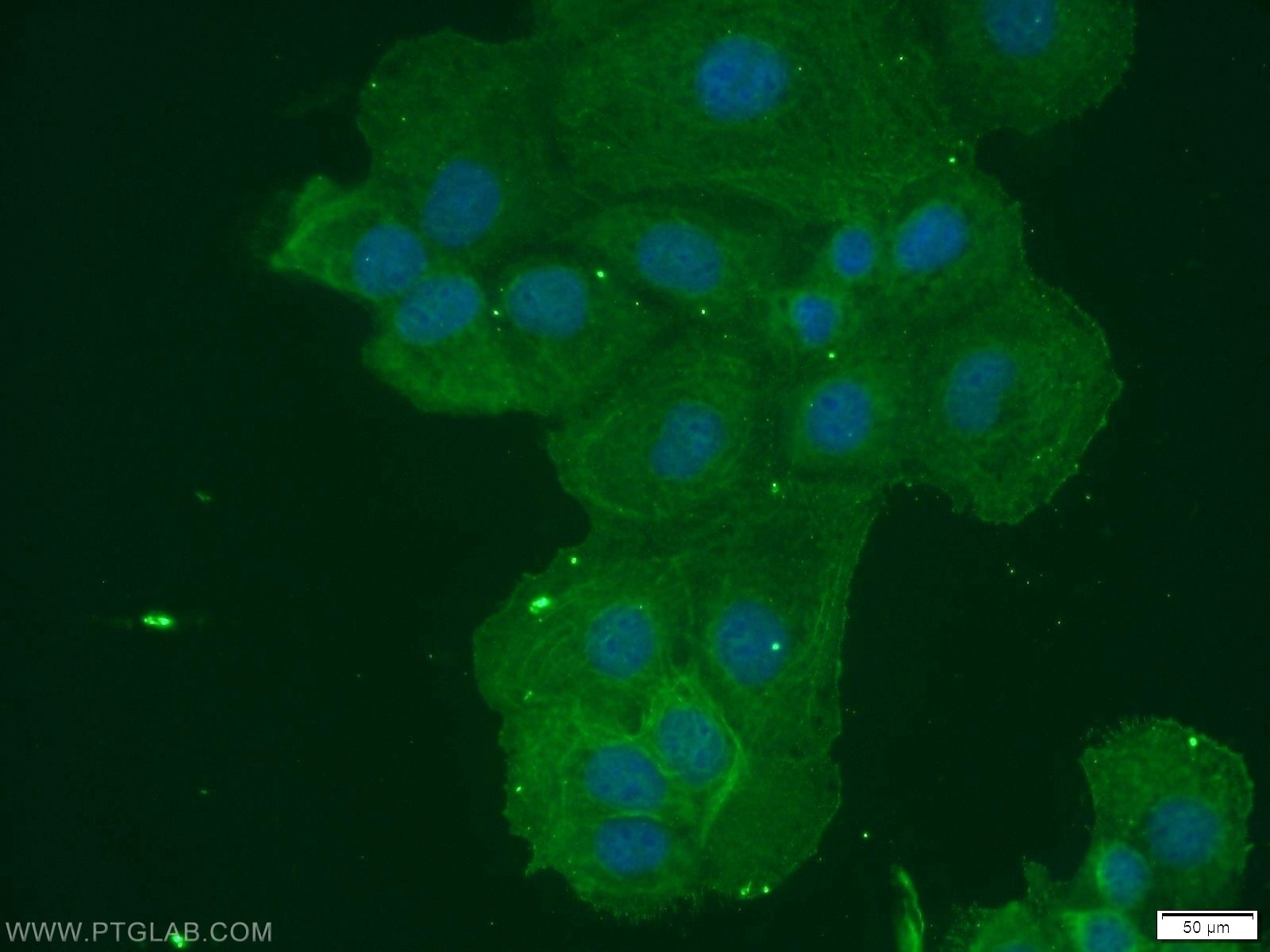 Immunofluorescence (IF) / fluorescent staining of A431 cells using CCL27 Polyclonal antibody (22301-1-AP)