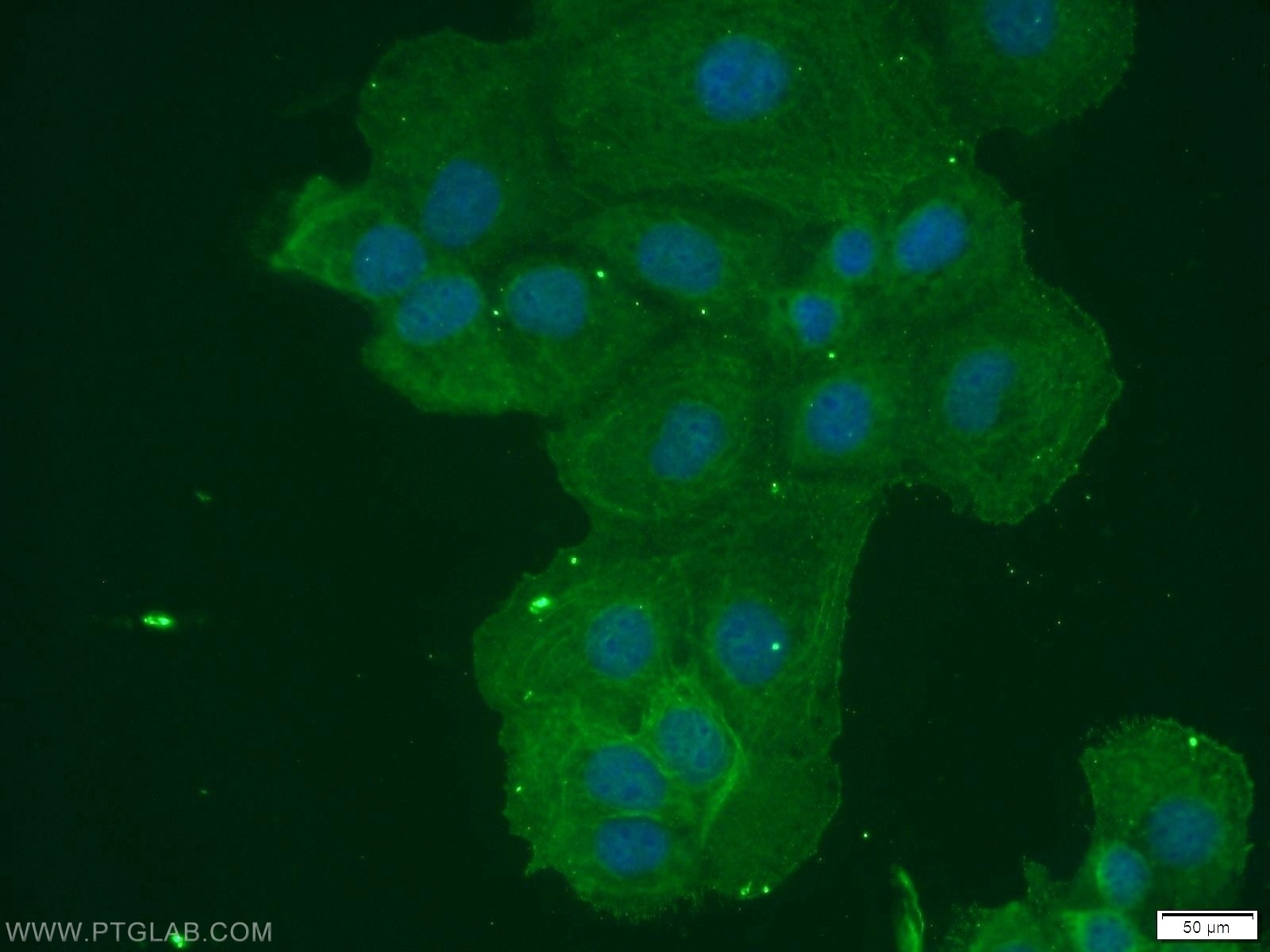 IF Staining of A431 using 22301-1-AP