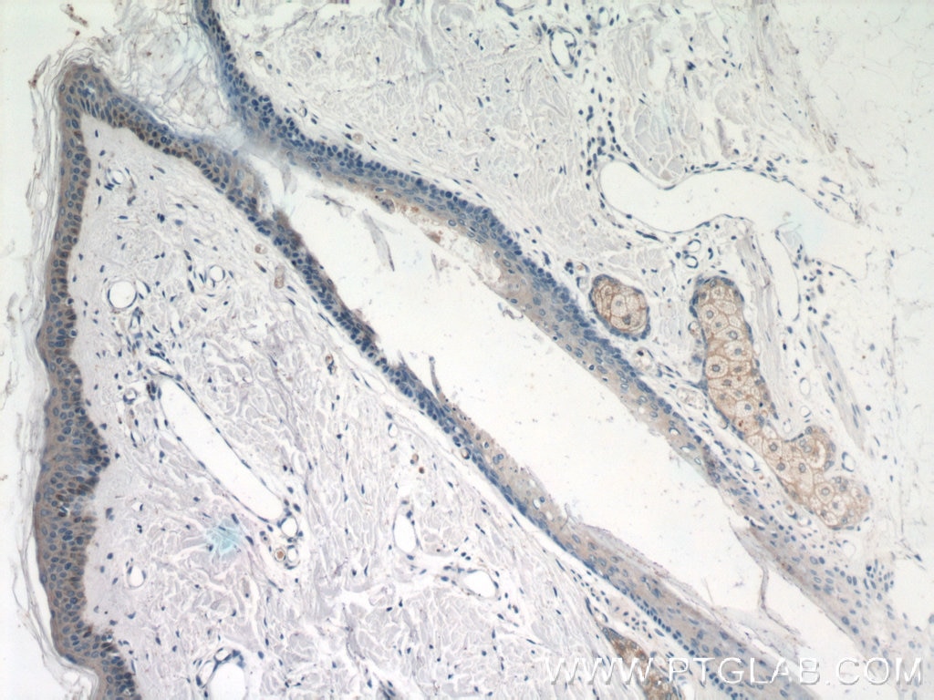 Immunohistochemistry (IHC) staining of human skin tissue using CCL27 Polyclonal antibody (22301-1-AP)