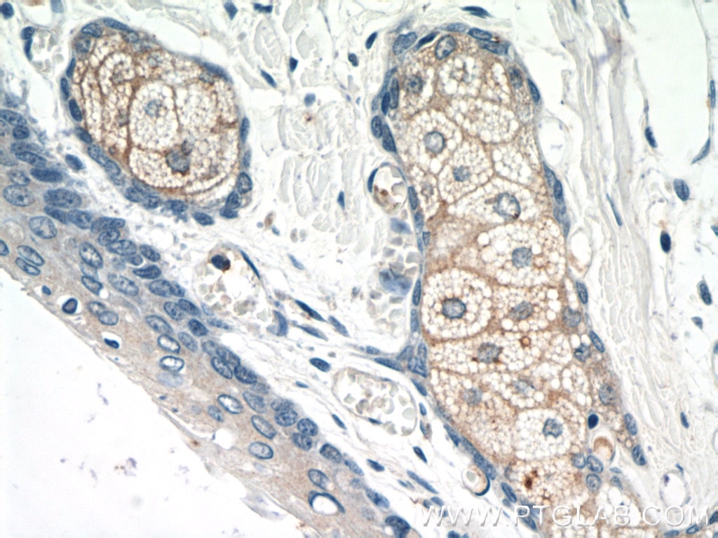 Immunohistochemistry (IHC) staining of human skin tissue using CCL27 Polyclonal antibody (22301-1-AP)