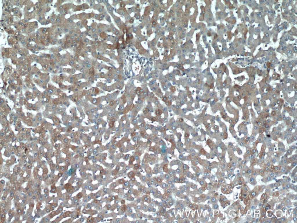 Immunohistochemistry (IHC) staining of human liver tissue using CCL27 Polyclonal antibody (22301-1-AP)