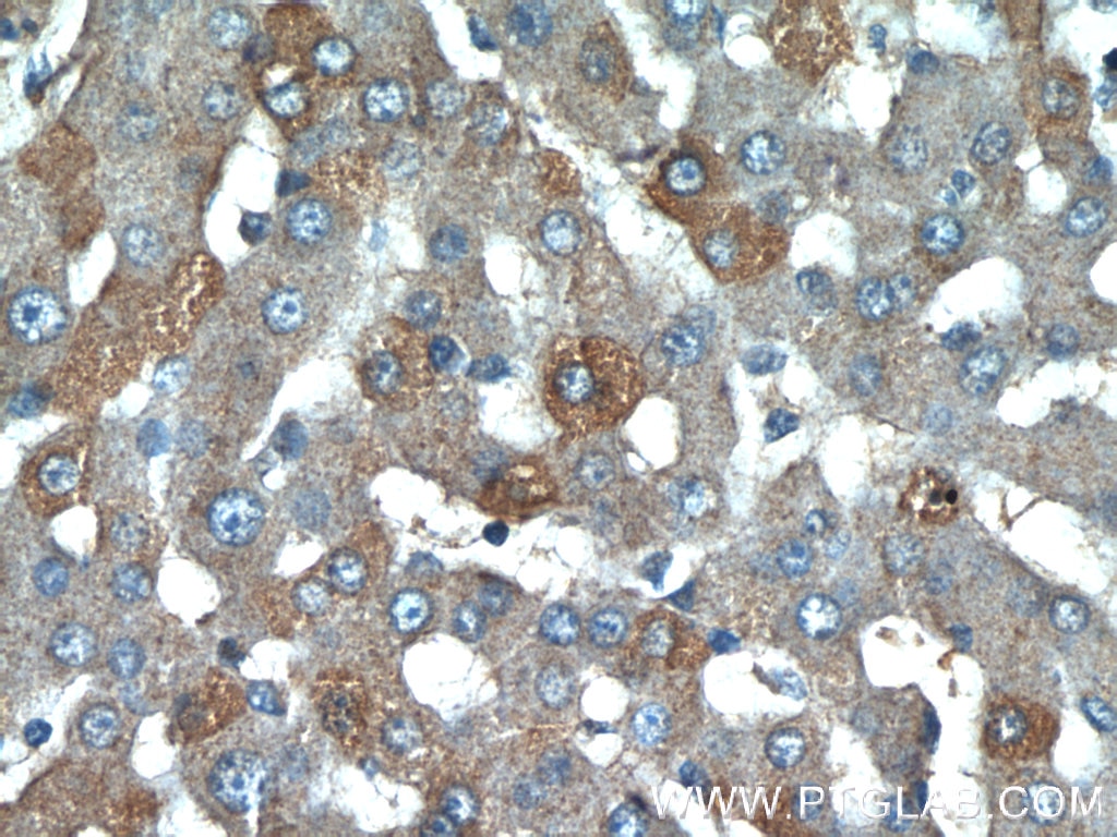 Immunohistochemistry (IHC) staining of human liver tissue using CCL27 Polyclonal antibody (22301-1-AP)