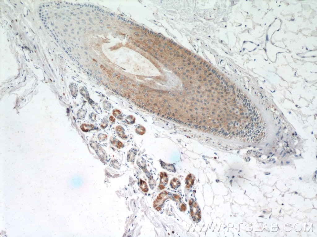 IHC staining of human skin using 22301-1-AP