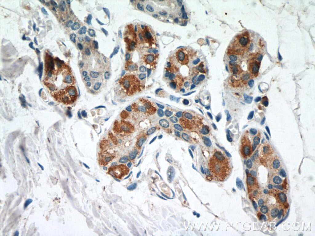 Immunohistochemistry (IHC) staining of human skin tissue using CCL27 Polyclonal antibody (22301-1-AP)