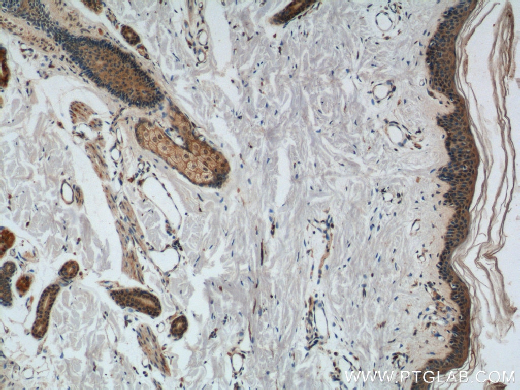 Immunohistochemistry (IHC) staining of human skin tissue using CCL27 Polyclonal antibody (22301-1-AP)