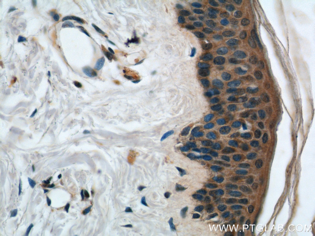 IHC staining of human skin using 22301-1-AP