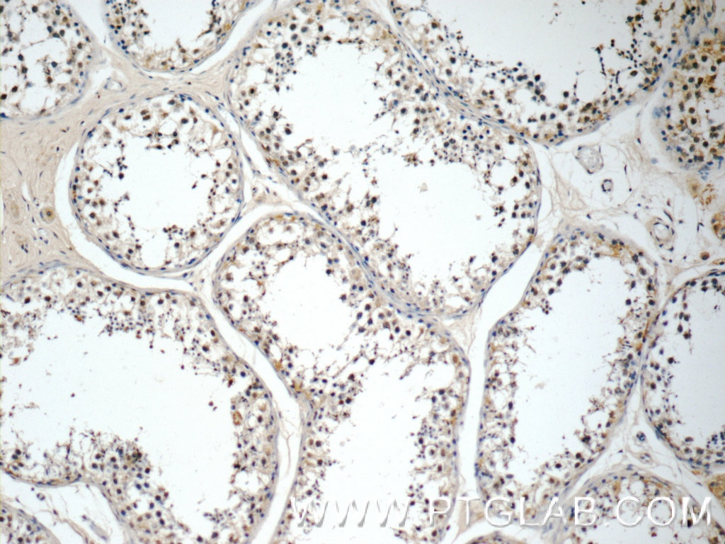 Immunohistochemistry (IHC) staining of human testis tissue using CCL27 Polyclonal antibody (22301-1-AP)