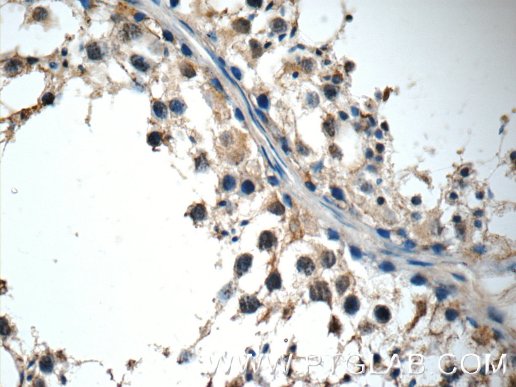 IHC staining of human testis using 22301-1-AP