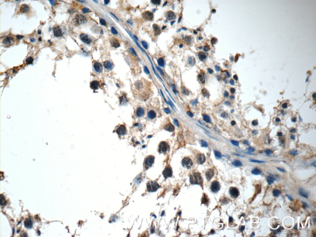 Immunohistochemistry (IHC) staining of human testis tissue using CCL27 Polyclonal antibody (22301-1-AP)