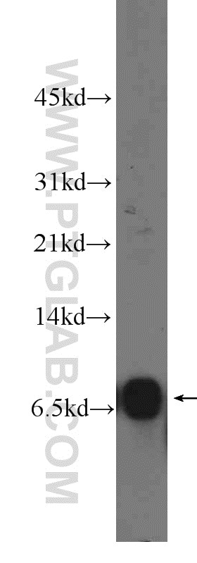 Western Blot (WB) analysis of PC-3 cells using CCL28 Polyclonal antibody (18214-1-AP)