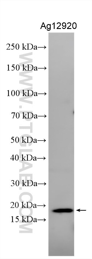 Recombinant protein were subjected to SDS PAGE followed by western blot with 18214-1-AP (CCL28 antibody) at dilution of 1:2000 incubated at room temperature for 1.5 hours. Western Blot (WB) analysis of various lysates using CCL28 Polyclonal antibody (18214-1-AP)