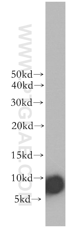 Western Blot (WB) analysis of Jurkat cells using CCL28 Polyclonal antibody (18214-1-AP)