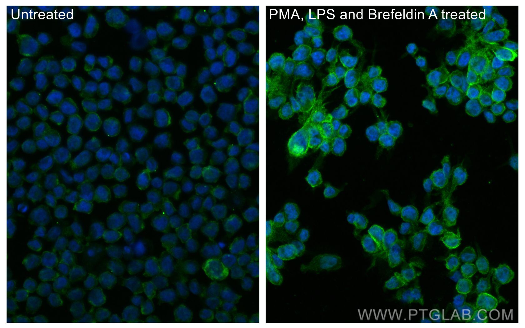 Immunofluorescence (IF) / fluorescent staining of THP-1 cells using CCL3 Polyclonal antibody (32190-1-AP)