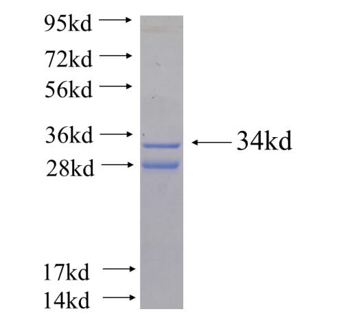 CCL4 fusion protein Ag25070 SDS-PAGE